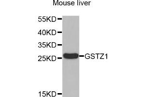 Western blot analysis of extracts of Mouse liver , using GSTZ1 antibody.