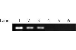 RbAp46/48 antibody (pAb) tested by ChIP ChIP performed on MCF7 cell chromatin (40 μg) using 39198. (RbAp46/48 antibody)