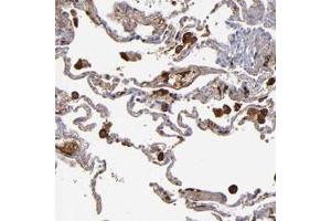 Immunohistochemical staining of human lung with C1QA polyclonal antibody  shows strong cytoplasmic positivity in macrophages.
