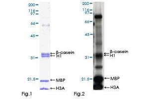 Kinase Activity Assay (KAA) image for Dual-Specificity tyrosine-(Y)-phosphorylation Regulated Kinase 2 (DYRK2) (AA 1-528) protein (GST tag) (ABIN1352206) (DYRK2 Protein (AA 1-528) (GST tag))