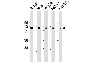 All lanes : Anti-PSMD3 Antibody (C-Term) at 1:2000 dilution Lane 1: Jurkat whole cell lysate Lane 2: Hela whole cell lysate Lane 3: HepG2 whole cell lysate Lane 4: MCF-7 whole cell lysate Lane 5: NIH/3T3 whole cell lysate Lysates/proteins at 20 μg per lane. (PSMD3 antibody  (AA 482-515))