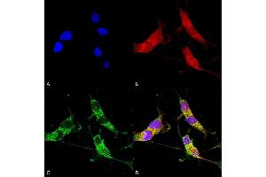 Immunocytochemistry/Immunofluorescence analysis using Mouse Anti-VGLUT2 Monoclonal Antibody, Clone S29-29 (ABIN2483733).