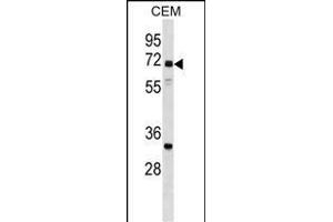 NPLOC4 Antibody (C-term) (ABIN1537359 and ABIN2848982) western blot analysis in CEM cell line lysates (35 μg/lane). (NPLOC4 antibody  (C-Term))
