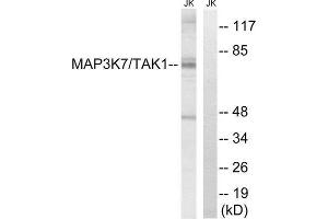 Western Blotting (WB) image for anti-Mitogen-Activated Protein Kinase Kinase Kinase 7 (MAP3K7) (Thr187) antibody (ABIN1848229) (MAP3K7 antibody  (Thr187))