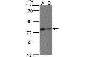WB Image Sample(30 μg of whole cell lysate) A:293T B:A431, 7. (MTA2 antibody  (C-Term))
