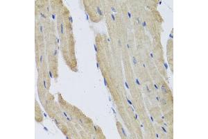 Immunohistochemistry of paraffin-embedded mouse heart using PRPH antibody (ABIN5972212) at dilution of 1/100 (40x lens). (Peripherin antibody)