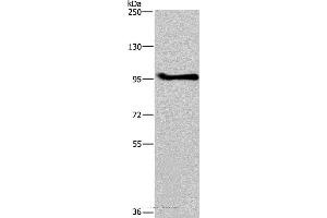 Western blot analysis of A549 cell, using LLGL1 Polyclonal Antibody at dilution of 1:350 (LLGL1 antibody)