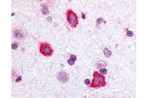 Anti-GALR3 antibody IHC of rat brain, hippocampus. (GALR3 antibody  (Cytoplasmic Domain))