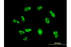 Immunofluorescence of purified MaxPab antibody to EXOSC7 on HeLa cell. (EXOSC7 antibody  (AA 1-291))