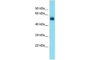 Host:  Rabbit  Target Name:  Taf1a  Sample Type:  Rat Brain lysates  Antibody Dilution:  1. (TAF1A antibody  (N-Term))