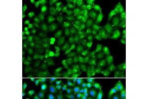 Immunofluorescence analysis of A549 cells using HLA-DRB1 Polyclonal Antibody (HLA-DRB1 antibody)