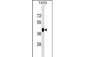 ZNF322A Antibody (C-term) (ABIN1537135 and ABIN2848990) western blot analysis in T47D cell line lysates (35 μg/lane). (ZNF322A antibody  (C-Term))