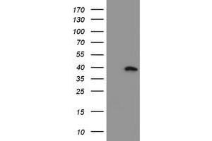 HEK293T cells were transfected with the pCMV6-ENTRY control (Left lane) or pCMV6-ENTRY MLF1 (Right lane) cDNA for 48 hrs and lysed. (MLF1 antibody)