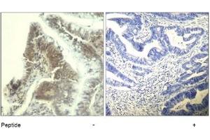 Image no. 1 for anti-Cyclin-Dependent Kinase 6 (CDK6) (Tyr13) antibody (ABIN319411) (CDK6 antibody  (Tyr13))