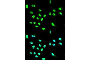 Immunofluorescence analysis of HepG2 cell using FCGR2A antibody. (FCGR2A antibody)