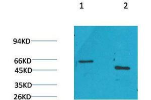 Western Blot (WB) analysis of 1) Rat Brain Tissue, 2)Mouse Brain Tissue with GLP1R Rabbit Polyclonal Antibody diluted at 1:2000. (GLP1R antibody)