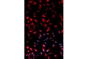 Immunofluorescence (IF) image for anti-Heat Shock 27kDa Protein 1 (HSPB1) (pSer82) antibody (ABIN1870246) (HSP27 antibody  (pSer82))