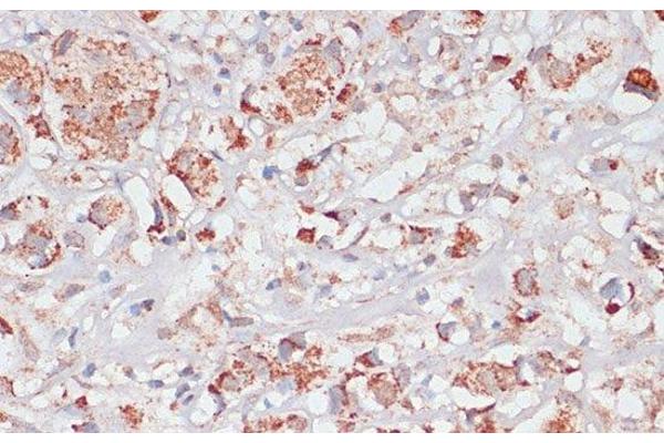 Desmoplakin antibody