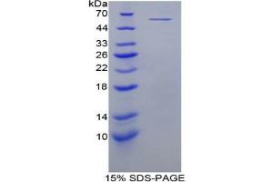 SDS-PAGE analysis of Mouse MYC Protein. (LMYC Protein)