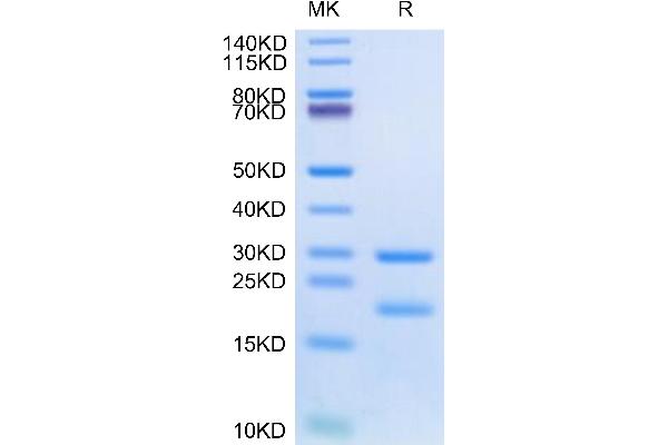 MASP2 Protein (AA 288-686) (His tag)