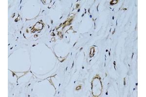 Immunohistochemistry of paraffin-embedded human breast using MCAM antibody (ABIN6290150) at dilution of 1:100 (40x lens). (MCAM antibody)
