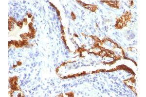 Immunohistochemistry (IHC) image for anti-Keratin 18 (KRT18) antibody (ABIN6939932)