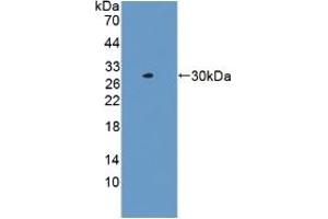 Detection of Recombinant LACTb, Human using Polyclonal Antibody to Lactamase Beta (LACTb) (LACTB antibody  (AA 313-547))