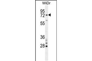 Western blot analysis in WiDr cell line lysates (35ug/lane). (BARD1 antibody  (N-Term))