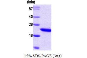 SDS-PAGE (SDS) image for Retinol Binding Protein 4, Plasma (RBP4) protein (ABIN667703) (RBP4 Protein)