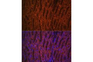 Immunofluorescence (IF) image for anti-phosphoenolpyruvate Carboxykinase 1 (Soluble) (PCK1) (C-Term) antibody (ABIN3022754)