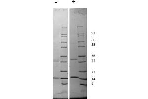 SDS-PAGE (SDS) image for Colony Stimulating Factor 2 (Granulocyte-Macrophage) (CSF2) protein (ABIN6699904)