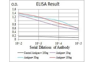 Black line: Control Antigen (100 ng), Purple line: Antigen(10 ng), Blue line: Antigen (50 ng), Red line: Antigen (100 ng), (TTR antibody  (AA 1-147))