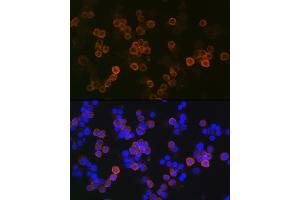 Immunofluorescence analysis of Raw264 7 cells using iNOS Rabbit mAb (ABIN1678965, ABIN3018084, ABIN3018085 and ABIN7101575) at dilution of 1:100 (40x lens). (NOS2 antibody)