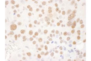 Immunohistochemistry (IHC) image for anti-Ubiquitin Specific Peptidase 7 (Herpes Virus-Associated) (USP7) (AA 1-50) antibody (ABIN7453454) (USP7 antibody  (AA 1-50))