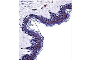 Immunohistochemistry (Paraffin-embedded Sections) (IHC (p)) image for anti-Tyrosinase (TYR) (C-Term) antibody (ABIN453446)