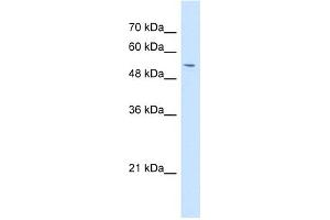 WB Suggested Anti-GPNMB Antibody Titration:  1 ug/ml  Positive Control:  HepG2 cell lysate (Osteoactivin antibody  (N-Term))