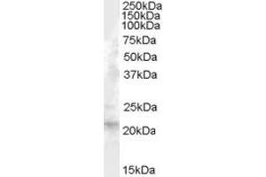 ABIN238569 (1µg/ml) staining of Human Liver lysate (35µg protein in RIPA buffer). (FGF21 antibody  (Internal Region))