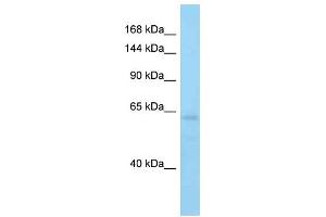 Host: Rabbit Target Name: Acin1 Sample Type: Mouse Brain lysates Antibody Dilution: 1. (ACIN1 antibody  (C-Term))