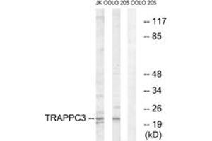 Western blot analysis of extracts from COLO/Jurkat cells, using TRAPPC3 Antibody. (TRAPPC3 antibody  (AA 131-180))