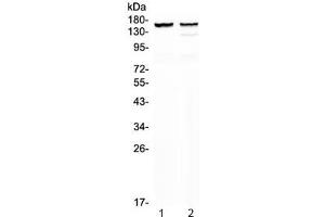 Western blot testing of 1) rat heart and 2) mouse heart lysate with MYBPC3 antibody at 0. (MYBPC3 antibody)