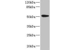 Western blot All lanes: KRT35 antibody at 4 μg/mL + PC-3 whole cell lysate Secondary Goat polyclonal to rabbit IgG at 1/10000 dilution Predicted band size: 51 kDa Observed band size: 51 kDa