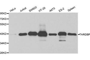 Western blot analysis of extracts of various cell lines, using TARDBP antibody.