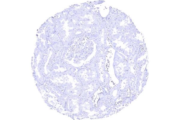 Recombinant Elastase 3B antibody  (AA 82-238)