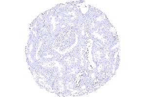 CELA3B immunostaining is absent in kidney tissue (Recombinant Elastase 3B antibody  (AA 82-238))