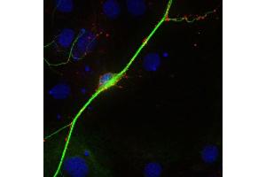 Indirect immunostaining of PFA fixed rat hippocampus neurons with anti-synaptoporin (1 : 500; red) and mouse anti-MAP 2 (, dilution 1 : 500; green). (Synaptoporin antibody  (C-Term))