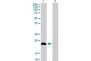 Western Blot analysis of DCTD expression in transfected 293T cell line by DCTD MaxPab polyclonal antibody. (DCMP Deaminase (DCTD) (AA 1-189) antibody)