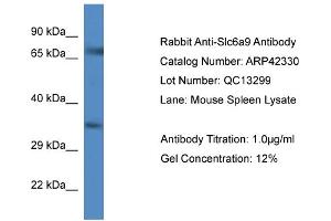 Host:  Rabbit  Target Name:  SLC6A9  Sample Tissue:  Mouse Spleen  Antibody Dilution:  1ug/ml (GLYT1 antibody  (C-Term))