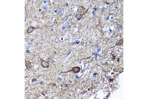 Immunohistochemistry of paraffin-embedded Mouse spinal cord using GULP1 Rabbit pAb (ABIN6131564, ABIN6141541, ABIN6141542 and ABIN6220256) at dilution of 1:100 (40x lens).