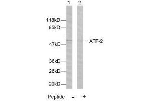 Image no. 2 for anti-Activating Transcription Factor 2 (ATF2) (Ser44), (Ser62) antibody (ABIN197144) (ATF2 antibody  (Ser44, Ser62))