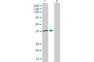 Western Blot analysis of MTMR1 expression in transfected 293T cell line by MTMR1 MaxPab polyclonal antibody. (MTMR1 antibody  (AA 1-363))